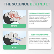 Anti Snore Mouth Guard Pro Snooze Therapy