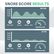 Anti Snore Mouth Guard Pro Snooze Therapy